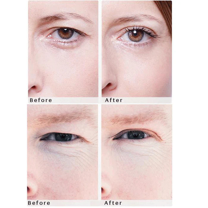 2 x 32 Patches Upper Eyelid Lifting Tape R714666