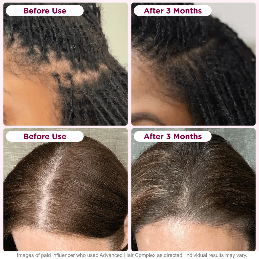 30 Capsules Hair Growth Supplement with Biotin A487480
