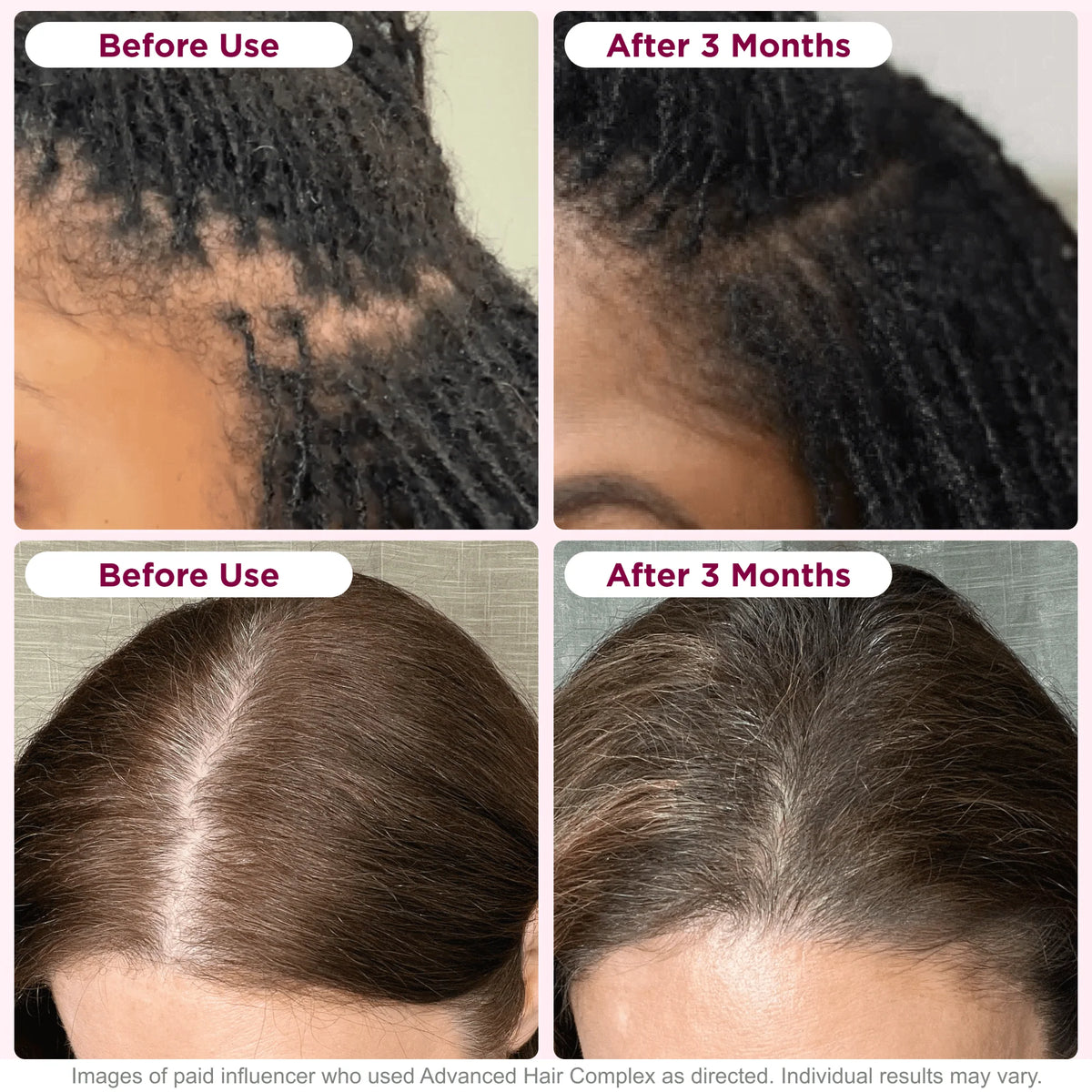 30 Capsules Hair Growth Supplement with Biotin A487480